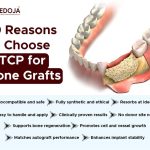 10 Reasons to Choose Beta-Tricalcium Phosphate for Bone Grafts