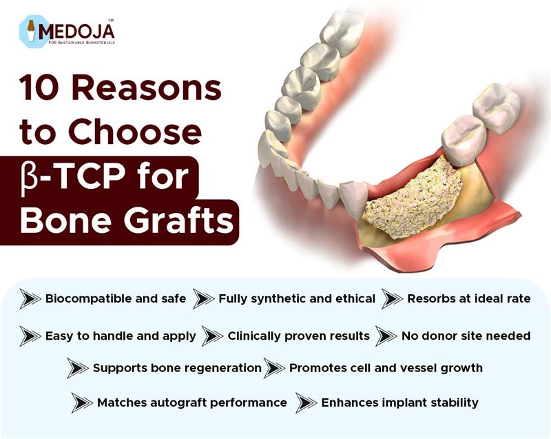 10 Reasons to Choose Beta-Tricalcium Phosphate for Bone Grafts