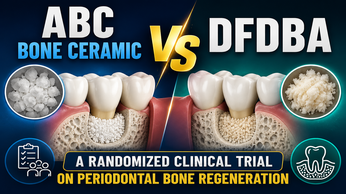 Angio-Osseo Inductive Bone Ceramic Research